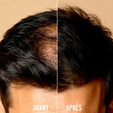 Full Hair Crème Correcteur Anti-Calvitie 50ml